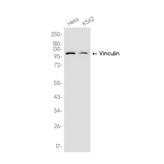 Vinculin Rabbit Monoclonal Antibody
