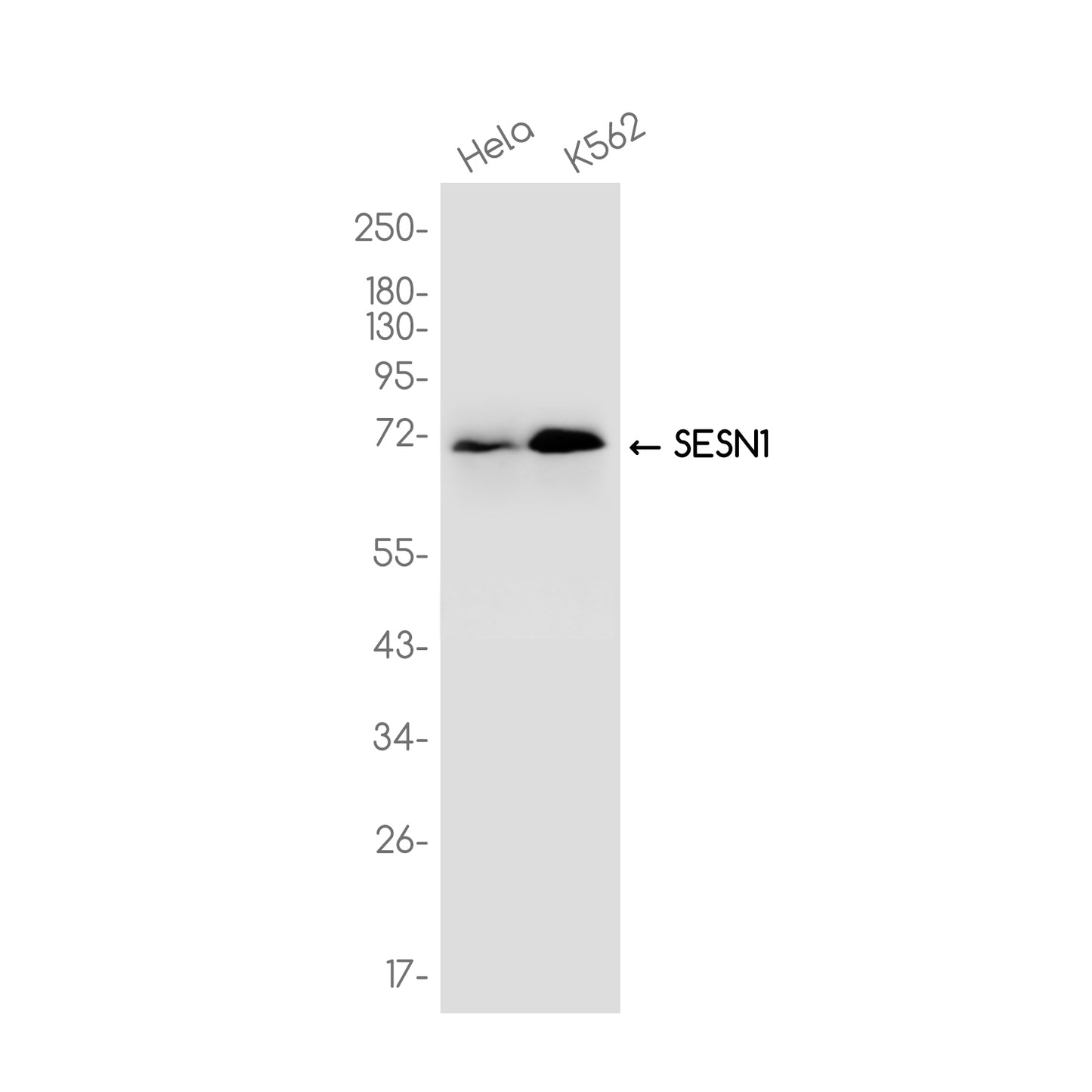 SESN1 Rabbit Monoclonal Antibody