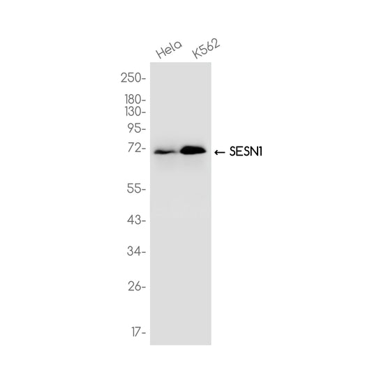 SESN1 Rabbit Monoclonal Antibody