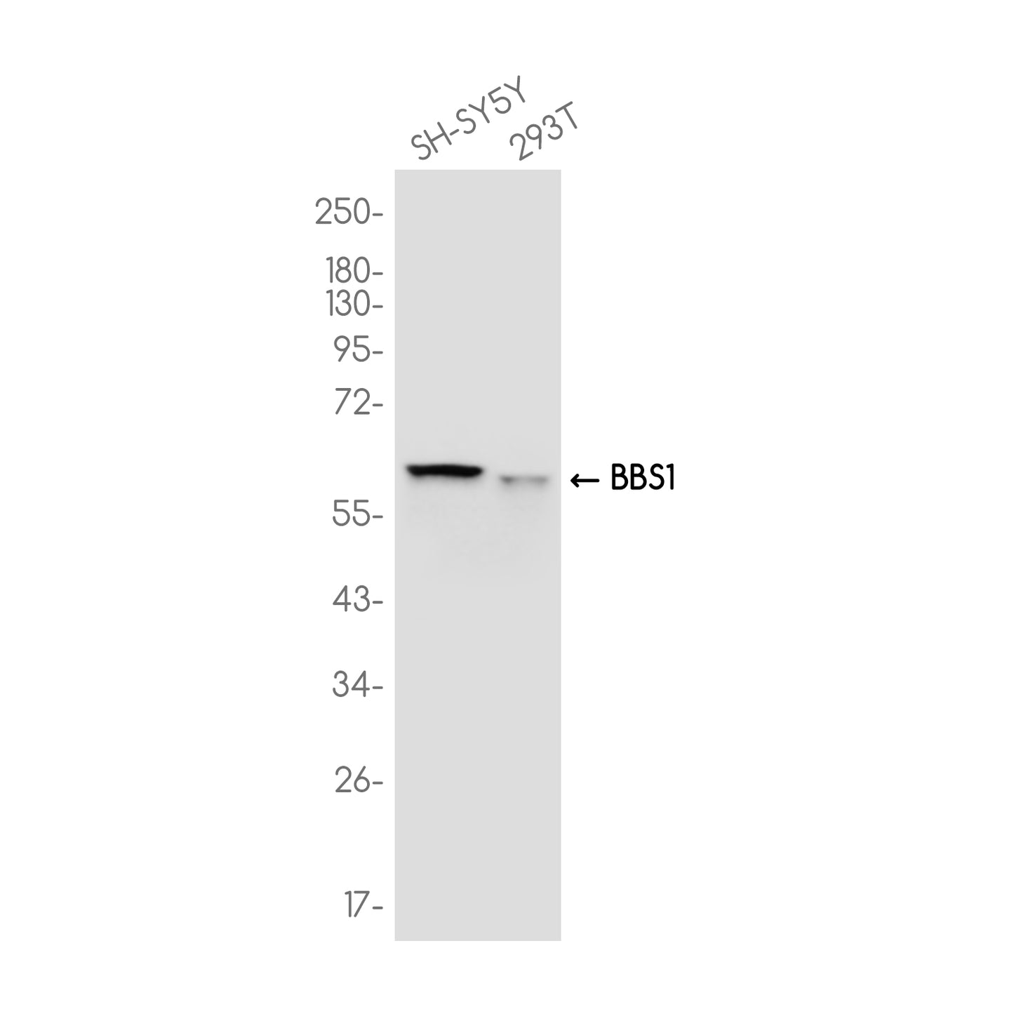 BBS1 Rabbit Monoclonal Antibody