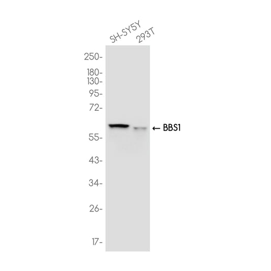 BBS1 Rabbit Monoclonal Antibody