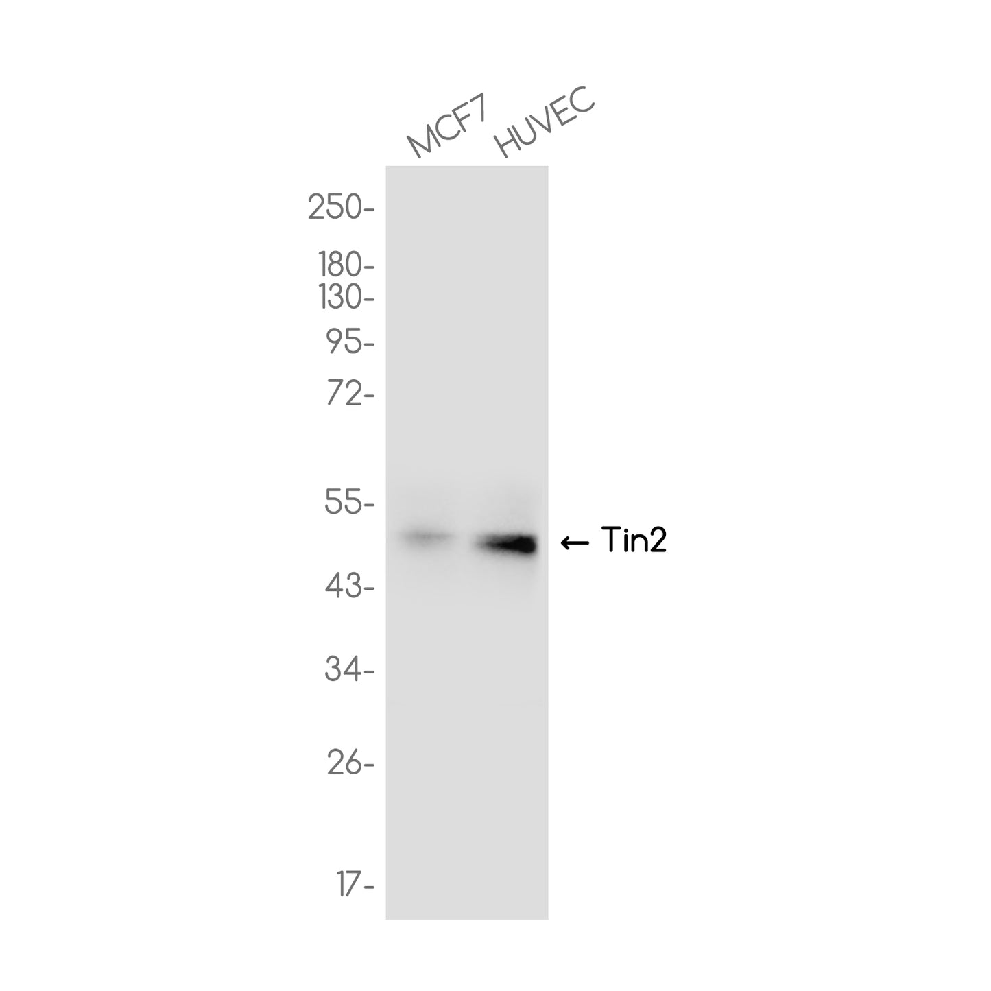 TINF2 Rabbit Monoclonal Antibody