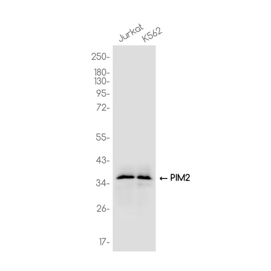 PIM2 Rabbit Monoclonal Antibody
