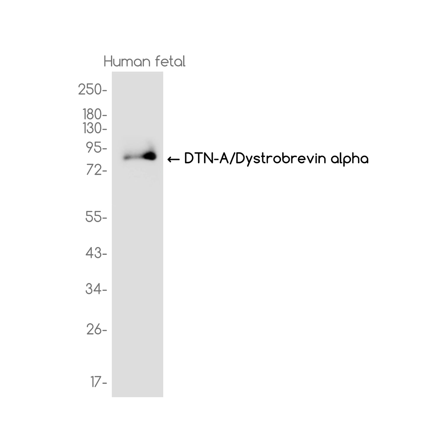 DTN-A Rabbit Monoclonal Antibody
