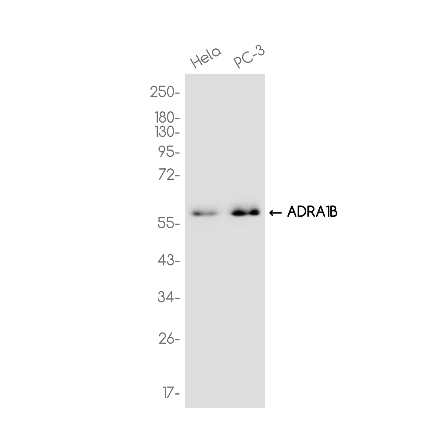 ADRA1B Rabbit Monoclonal Antibody