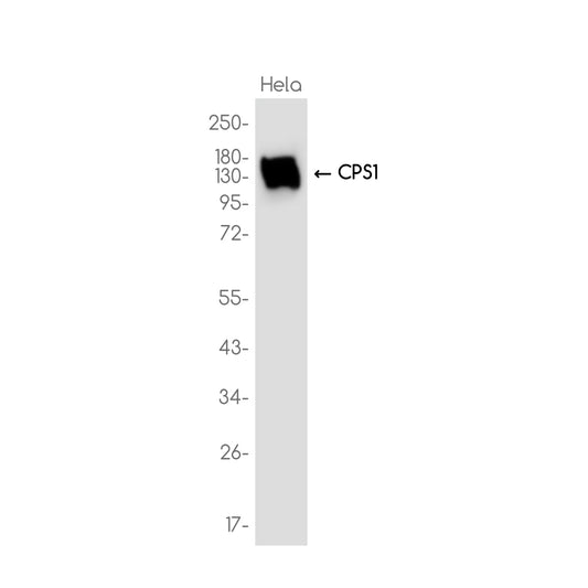 CPS1 Rabbit Monoclonal Antibody