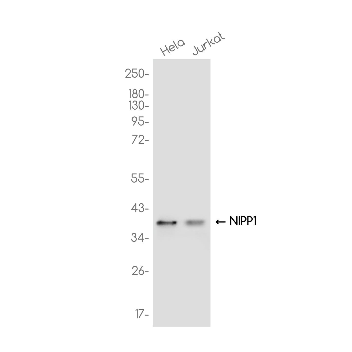 NIPP1 Rabbit Monoclonal Antibody
