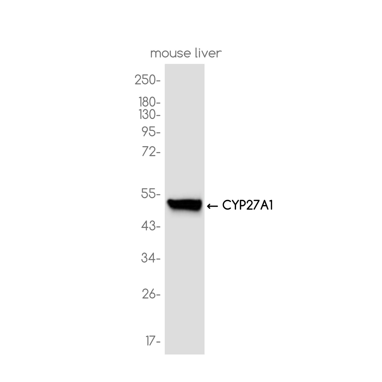 CYP27A1 Rabbit Monoclonal Antibody