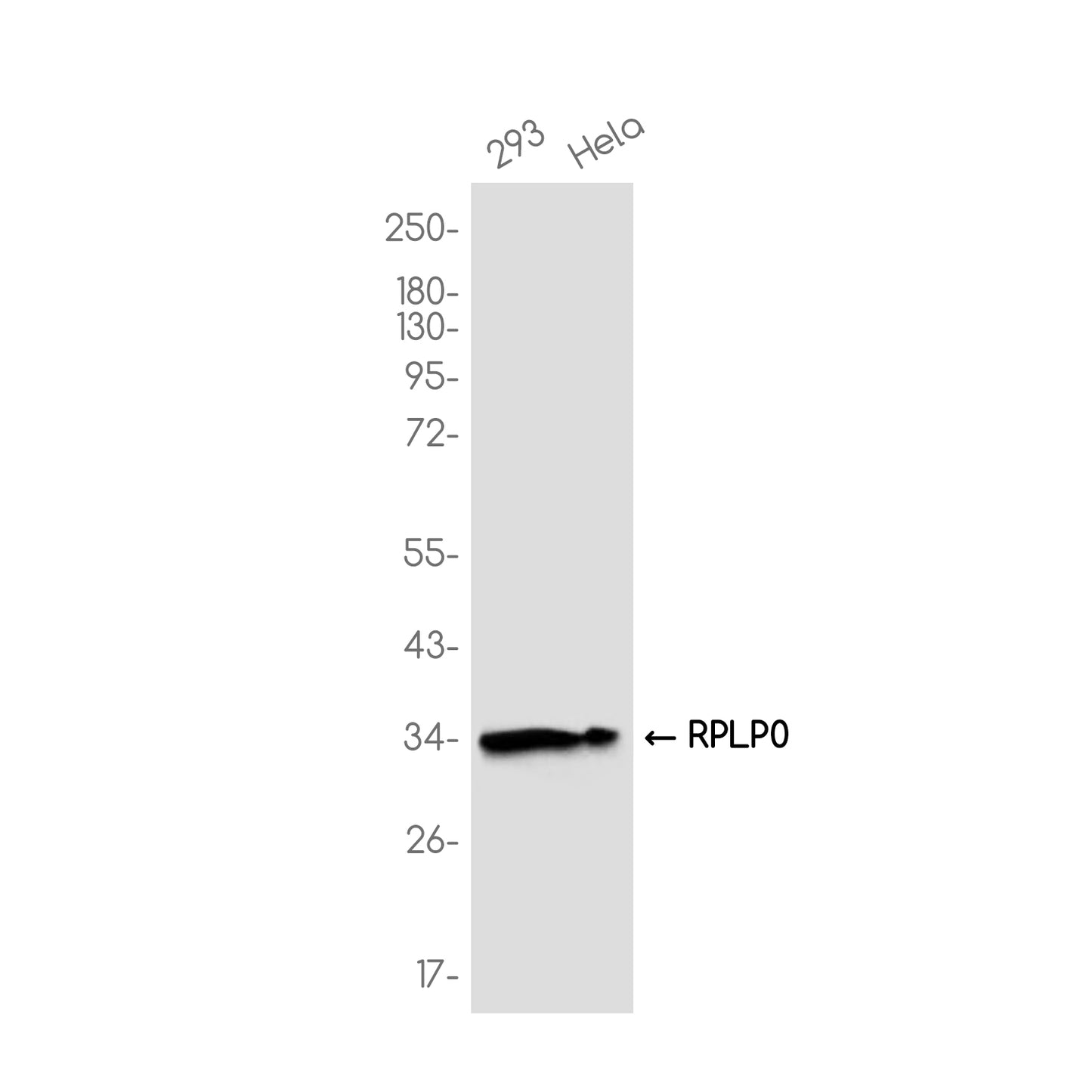 RPLP0 Rabbit Monoclonal Antibody