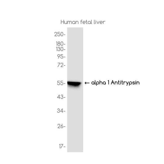 alpha 1-Antitrypsin Rabbit Monoclonal Antibody