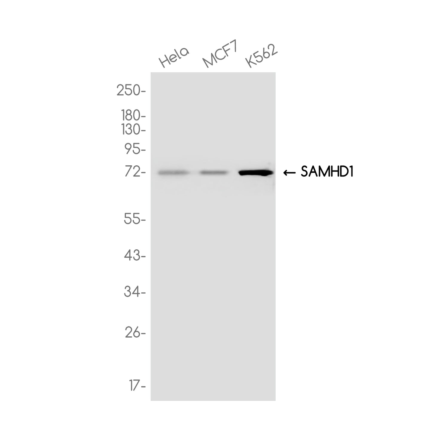 SAMHD1 Rabbit Monoclonal Antibody
