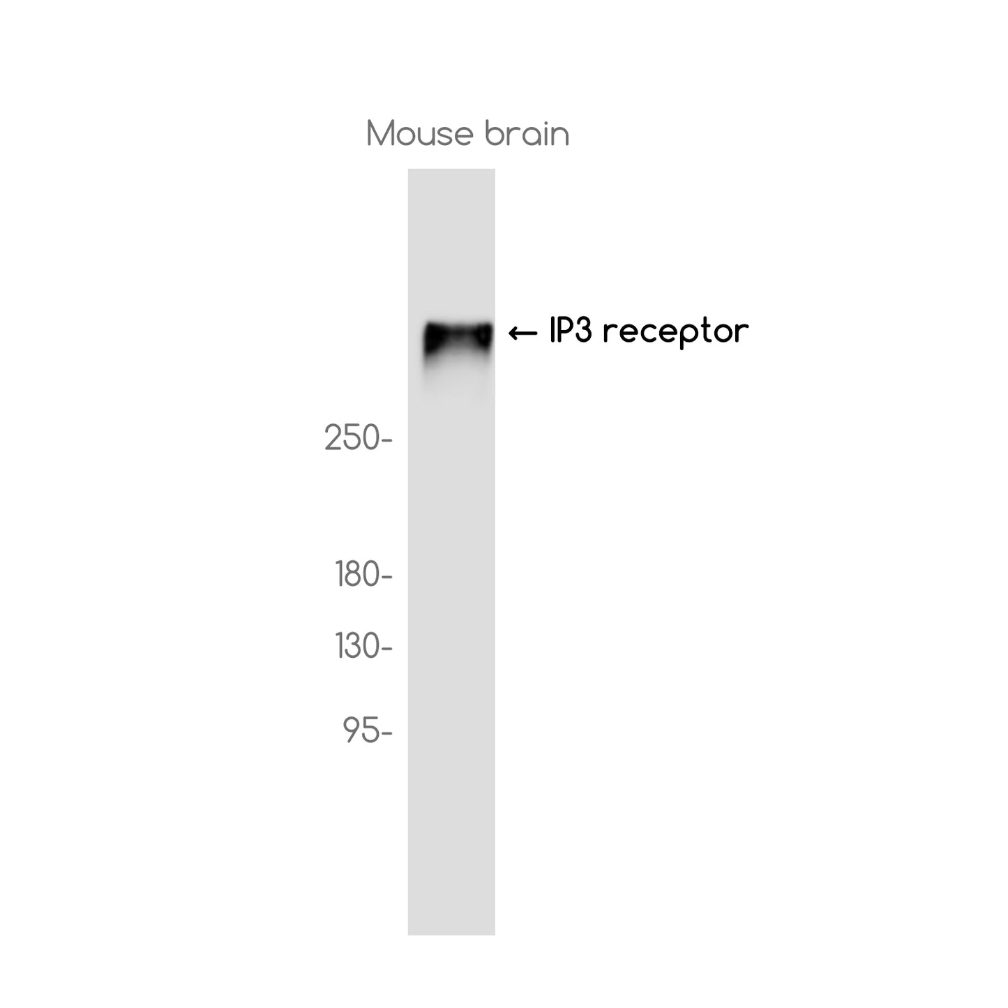 IP3 Receptor Rabbit Monoclonal Antibody