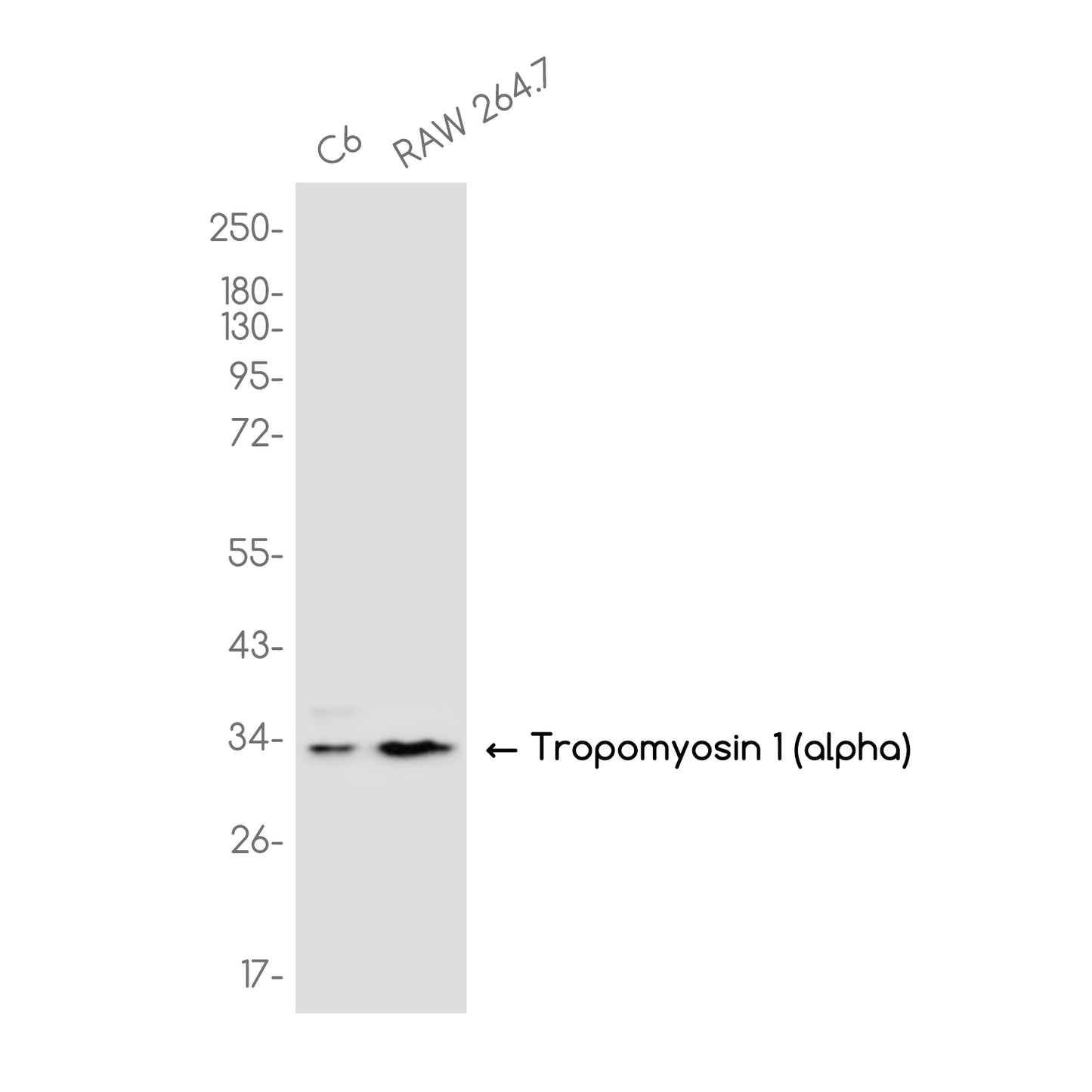 Tropomyosin alpha 1 Chain Rabbit Monoclonal Antibody