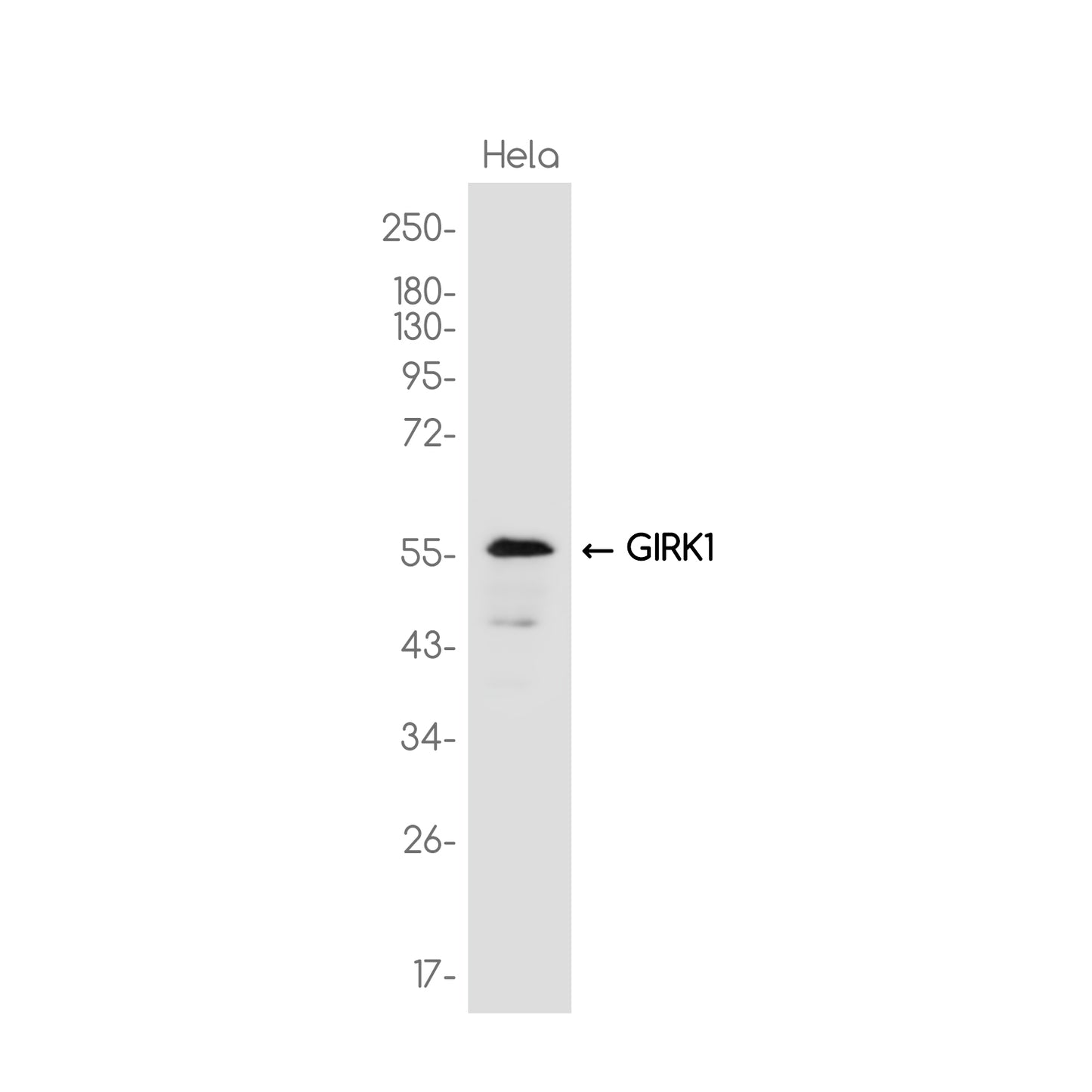 GIRK-1 Rabbit Monoclonal Antibody