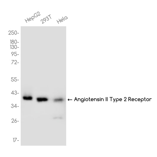 AGTR2 Receptor Rabbit Monoclonal Antibody