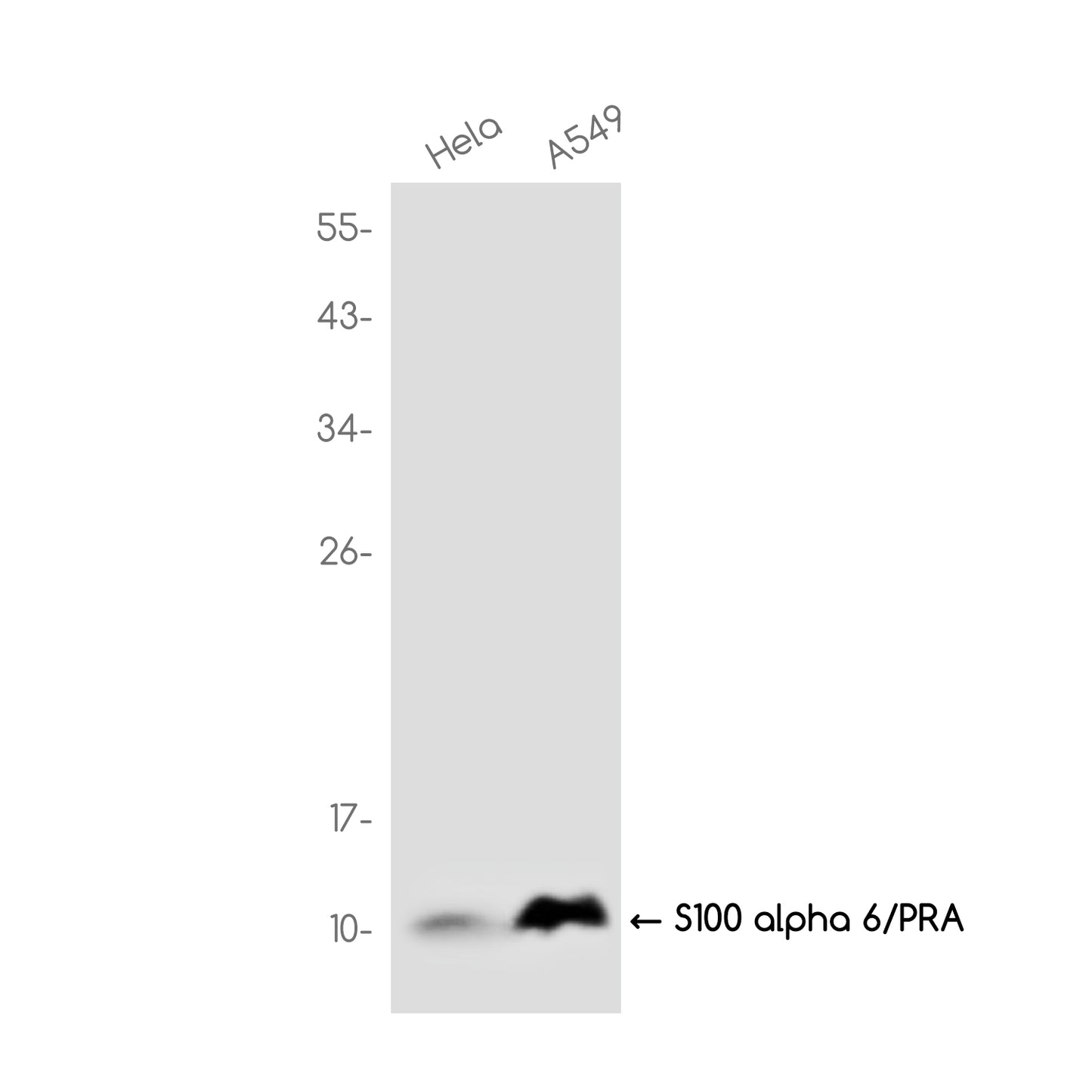 S100 alpha 6/PRA Rabbit Monoclonal Antibody