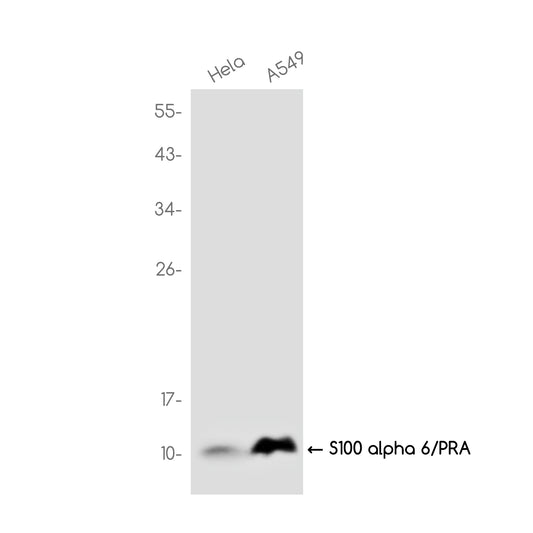 S100 alpha 6/PRA Rabbit Monoclonal Antibody