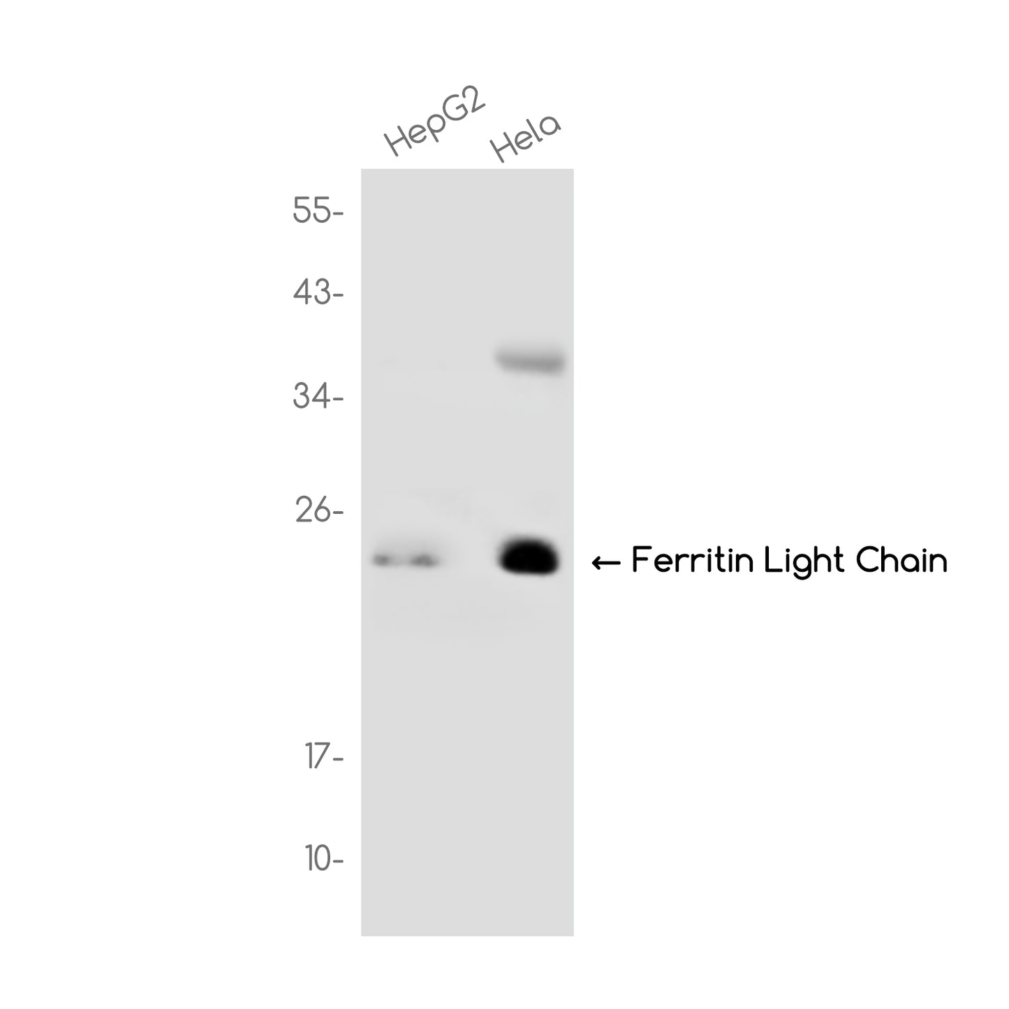 Ferritin Light Chain Rabbit Monoclonal Antibody