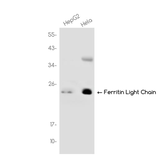 Ferritin Light Chain Rabbit Monoclonal Antibody