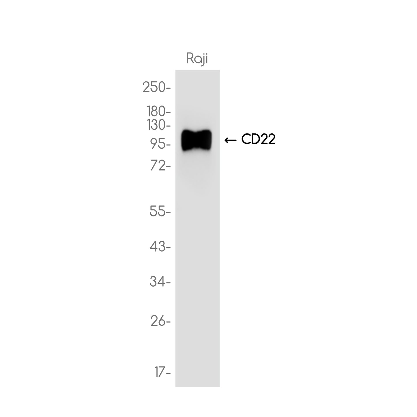 CD22 Rabbit Monoclonal Antibody