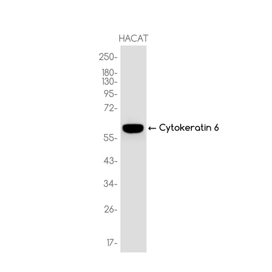 Cytokeratin 6 Rabbit Monoclonal Antibody