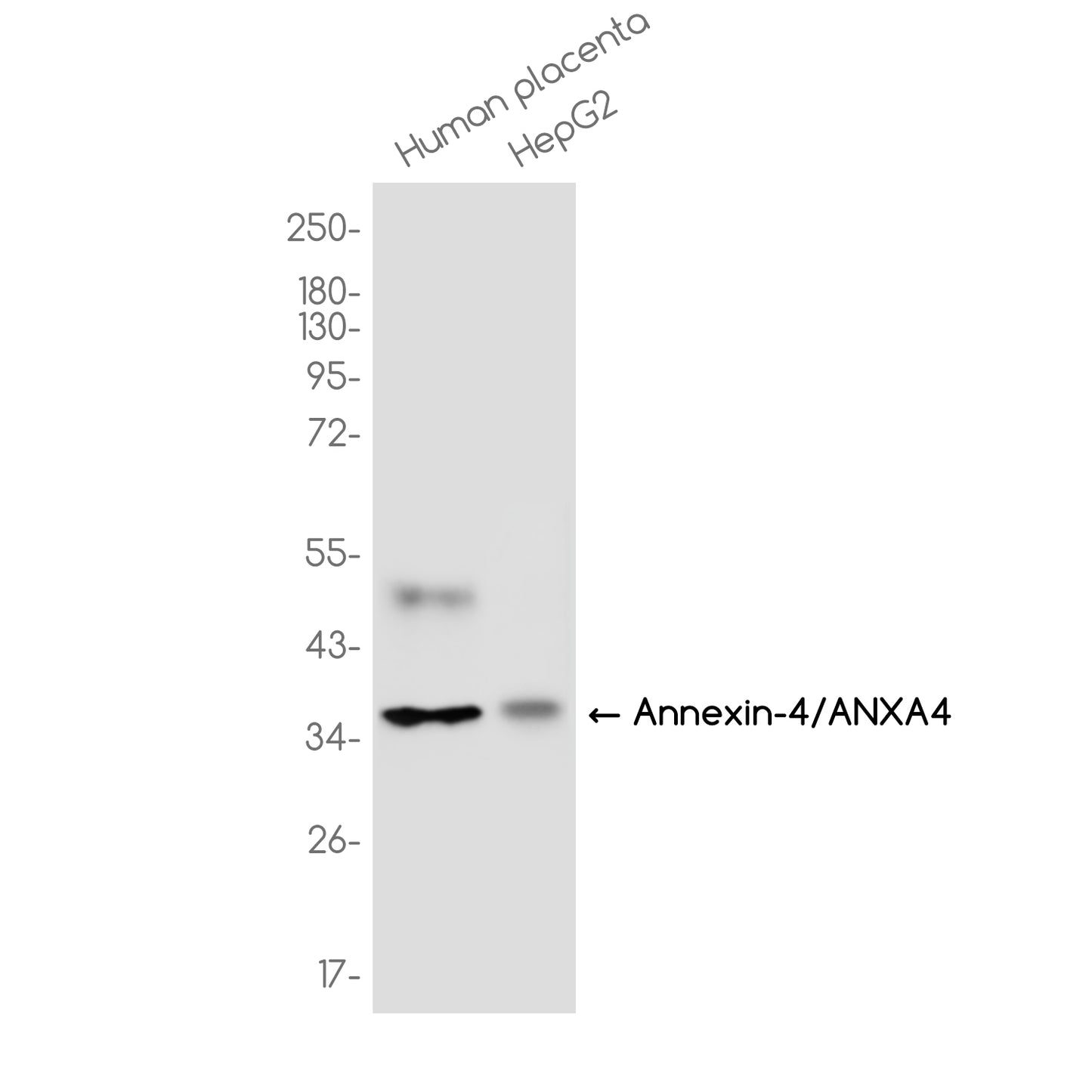 Annexin 4/ANXA4 Rabbit Monoclonal Antibody