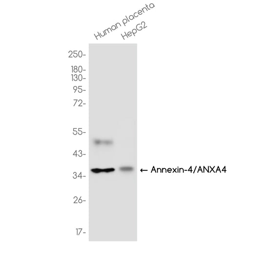 Annexin 4/ANXA4 Rabbit Monoclonal Antibody