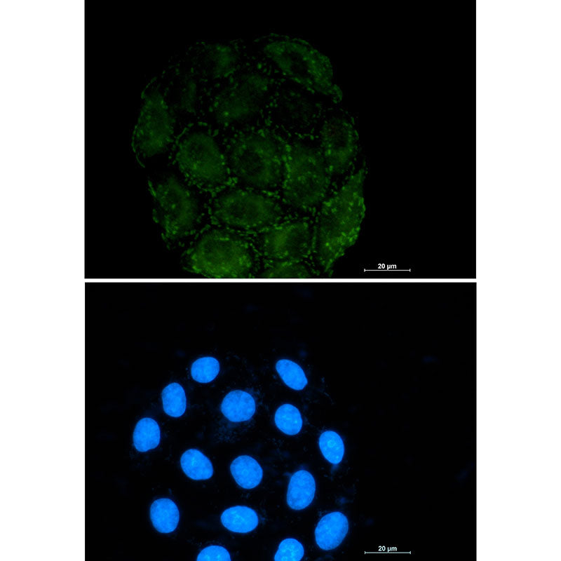 Integrin alpha V Rabbit Monoclonal Antibody
