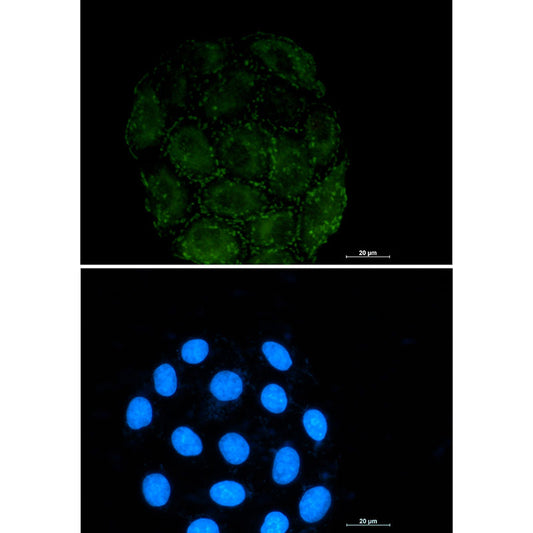 Integrin alpha V Rabbit Monoclonal Antibody