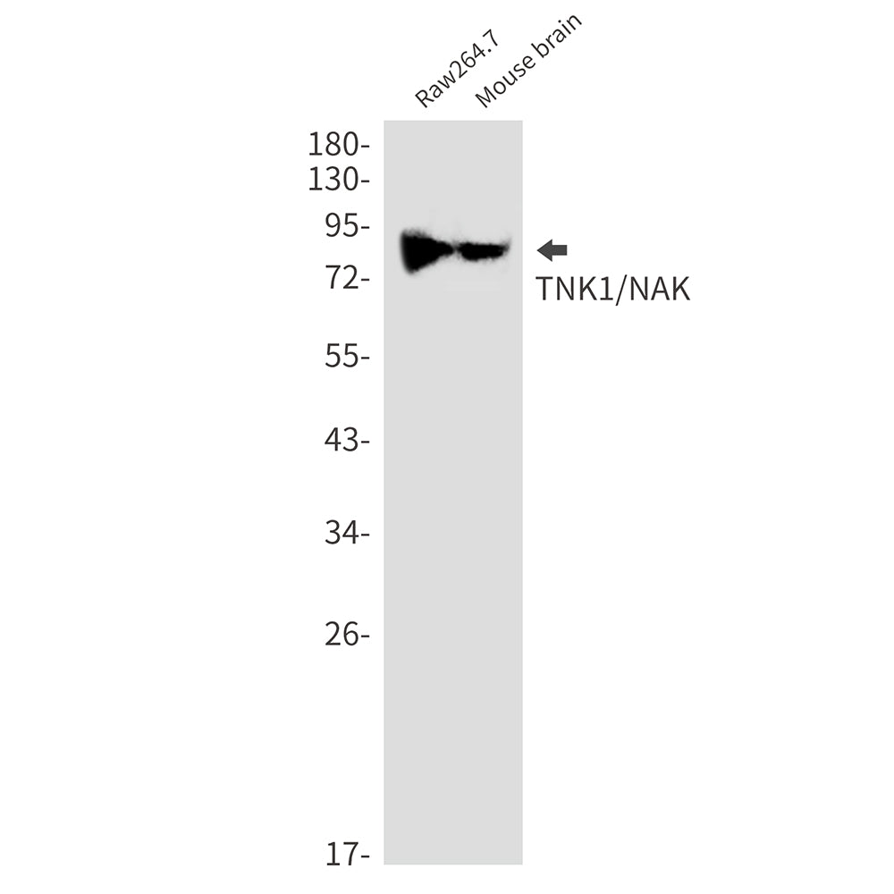 TBK1 Rabbit Monoclonal Antibody