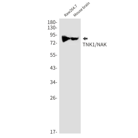 TBK1 Rabbit Monoclonal Antibody