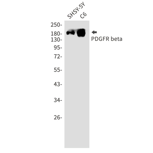 PDGFR beta Rabbit Monoclonal Antibody
