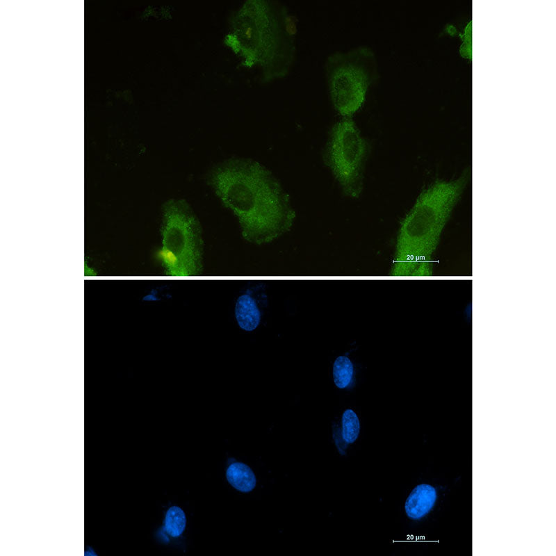 ALDOA Rabbit Monoclonal Antibody