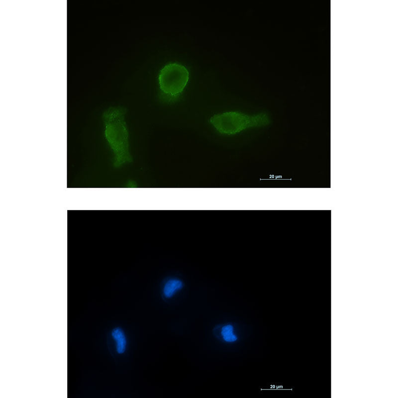 Bcl-XL Rabbit Monoclonal Antibody