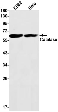 Catalase Rabbit Monoclonal Antibody