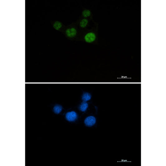 Chk2 Rabbit Monoclonal Antibody