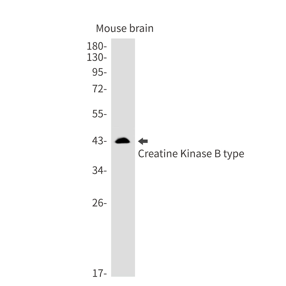 Creatine Kinase B type Rabbit Monoclonal Antibody