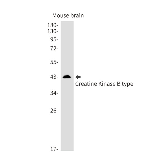 Creatine Kinase B type Rabbit Monoclonal Antibody