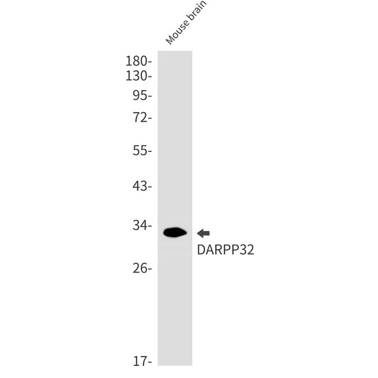 DARPP32 Rabbit Monoclonal Antibody