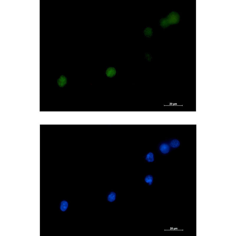 DKC1 Rabbit Monoclonal Antibody