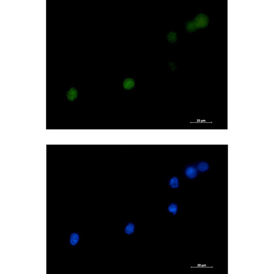 DKC1 Rabbit Monoclonal Antibody