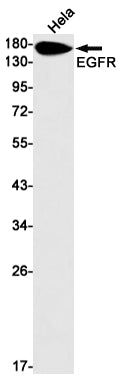 EGFR Rabbit Monoclonal Antibody