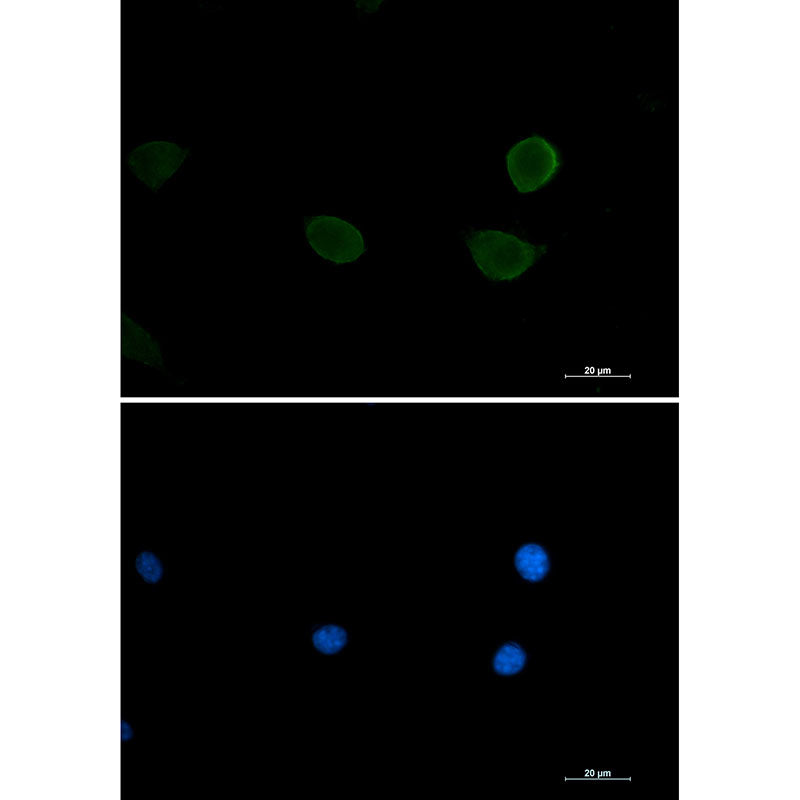 S6K2 Rabbit Monoclonal Antibody