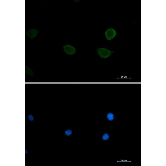 S6K2 Rabbit Monoclonal Antibody