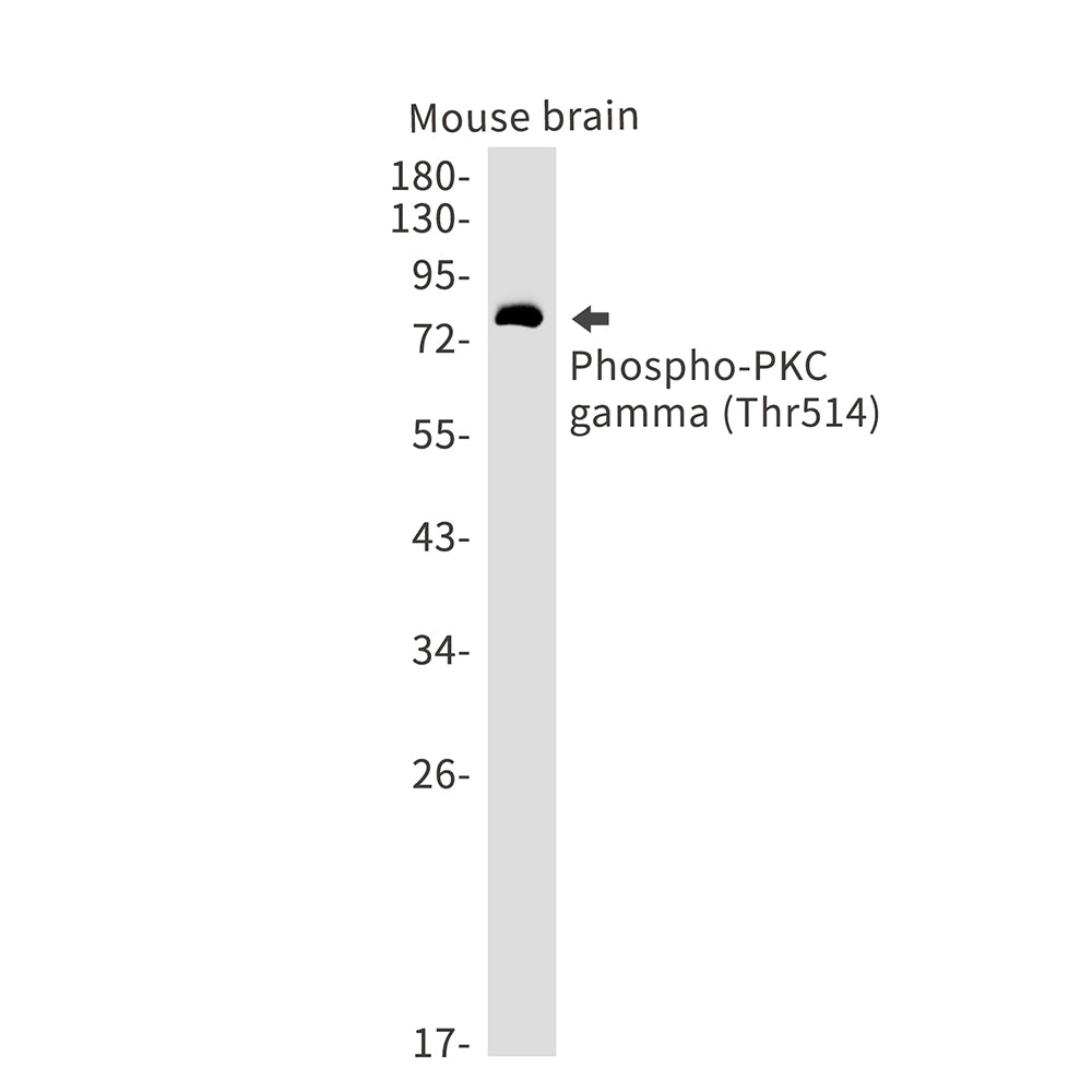 Phospho-PKC gamma (Thr514) Rabbit Monoclonal Antibody
