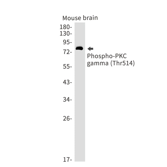 Phospho-PKC gamma (Thr514) Rabbit Monoclonal Antibody