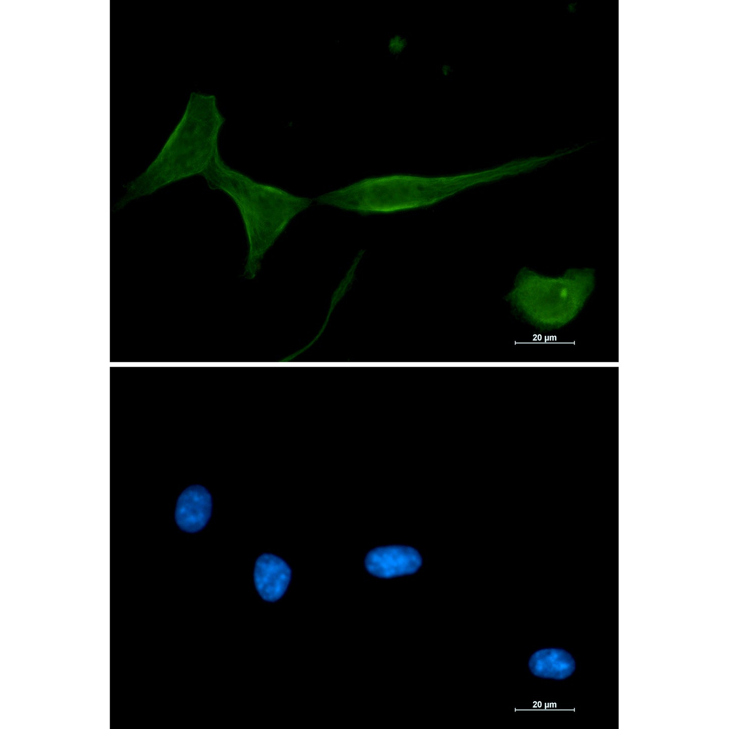PKC delta Rabbit Monoclonal Antibody