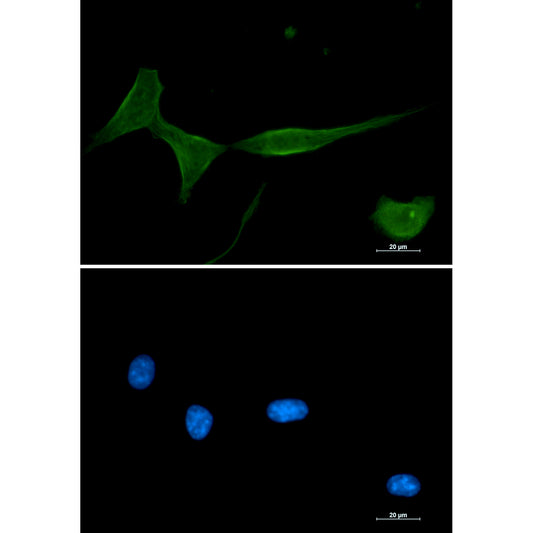 PKC delta Rabbit Monoclonal Antibody