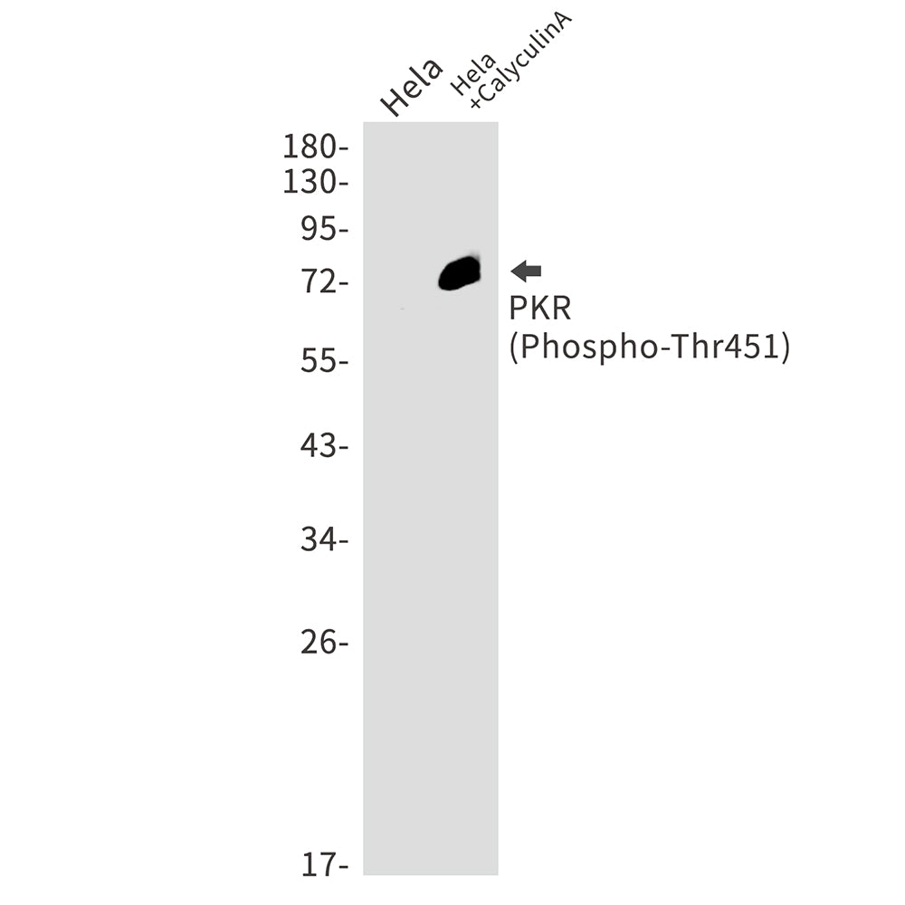 Phospho-PKR (Thr451) Rabbit Monoclonal Antibody