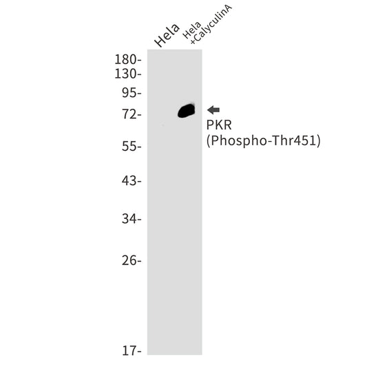 Phospho-PKR (Thr451) Rabbit Monoclonal Antibody
